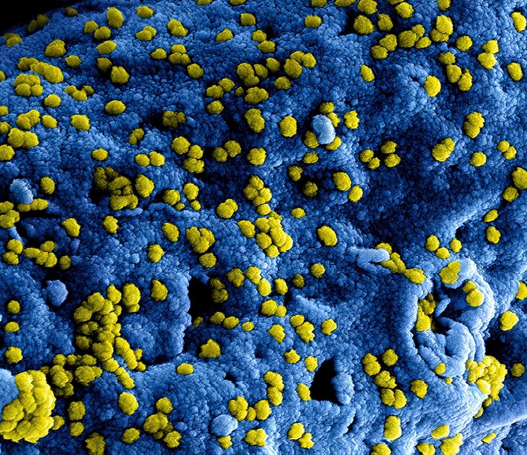 A blue and yellow substance with yellow dots from CDC on Unsplash Nghẹt mũi và nhiễm trùng khoang mũi
