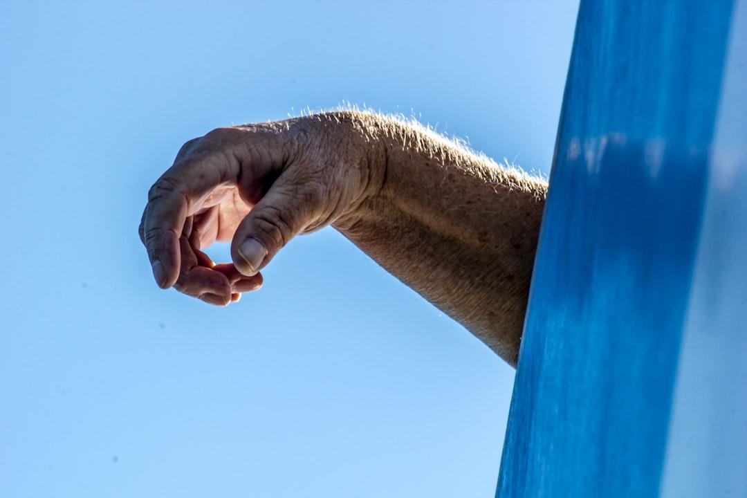 Person right hand from michael schaffler on Unsplash Phân biệt bệnh thủy đậu và bệnh tay-chân-miệng
