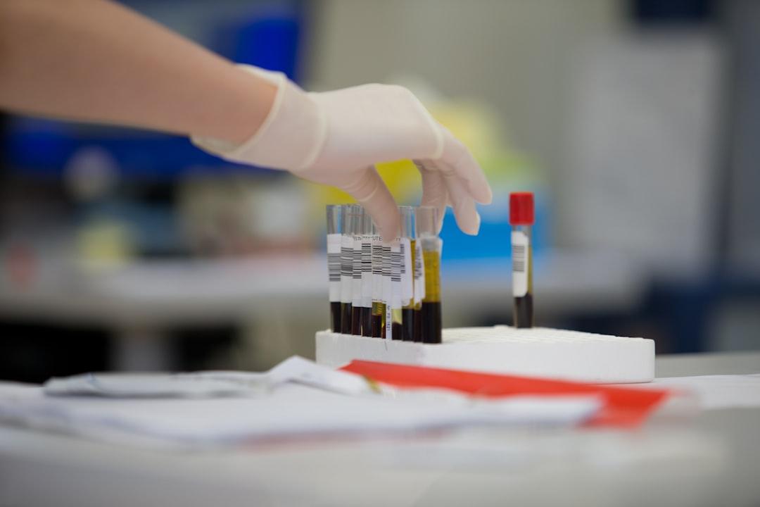 A person in white gloves is putting a bottle of wine in a test tube Công nghệ gene điều trị bệnh huyết áp cao